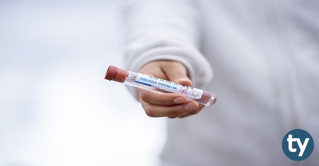 19 mart 2021 koronavirus tablosu durum gittikce kotulesiyor h12784 10767