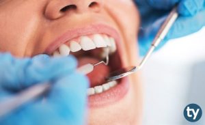 Ağız ve Diş Sağlığı Teknikeri KPSS 2019/4 Atama Taban Puanları