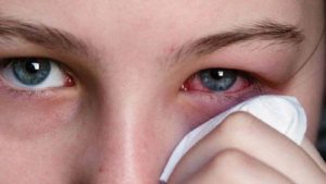 Göz Enfeksiyonu Nedir? Göz Enfeksiyonu Bulaşıcı Mı?