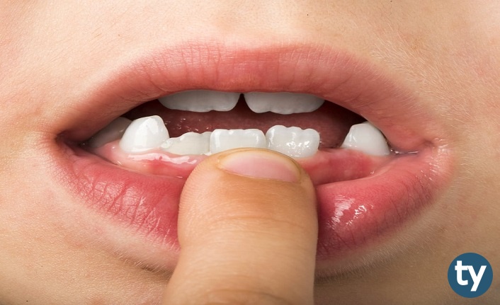 Diş Protez Teknisyeni Ne İş Yapar?