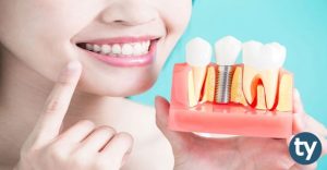 Diş Protez Teknolojisi 2020/1 KPSS Atama Taban Puanları