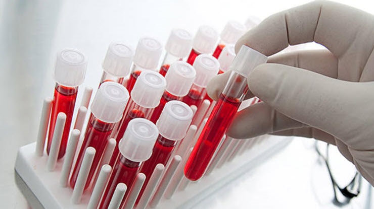 kan grubu nedir? nasıl öğrenilir? nereden öğrenilir? 2 kan grubu testi