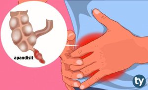 Kolonoskopi nedir ve nasıl yapılır?