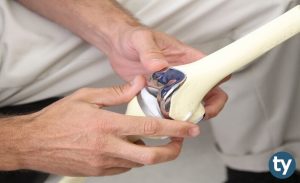 Ortopedi Teknikeri KPSS 2019/7 Atama Taban Puanları