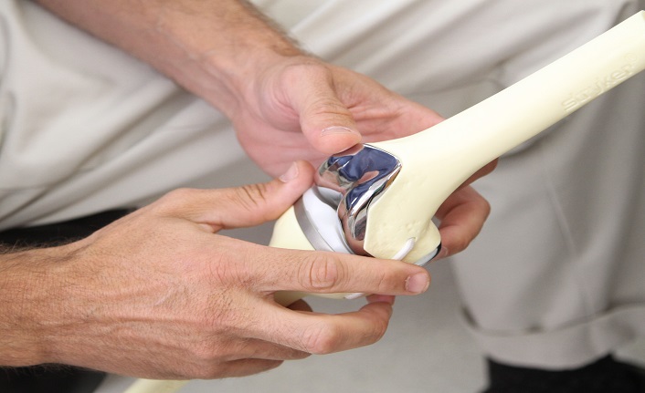 ortopedi teknisyeni nedir? ne i̇ş yapar? 1 ortopedi teknisyeni ne is yapar