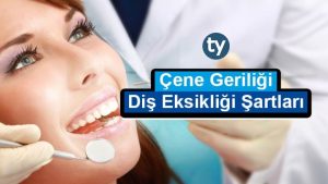 Polislik Diş Şartları 2023 Nelerdir?